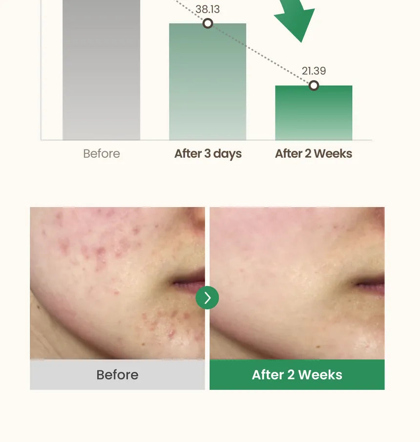 AXIS-Y - Mini Dark Spot Correcting Glow Serum 5ml